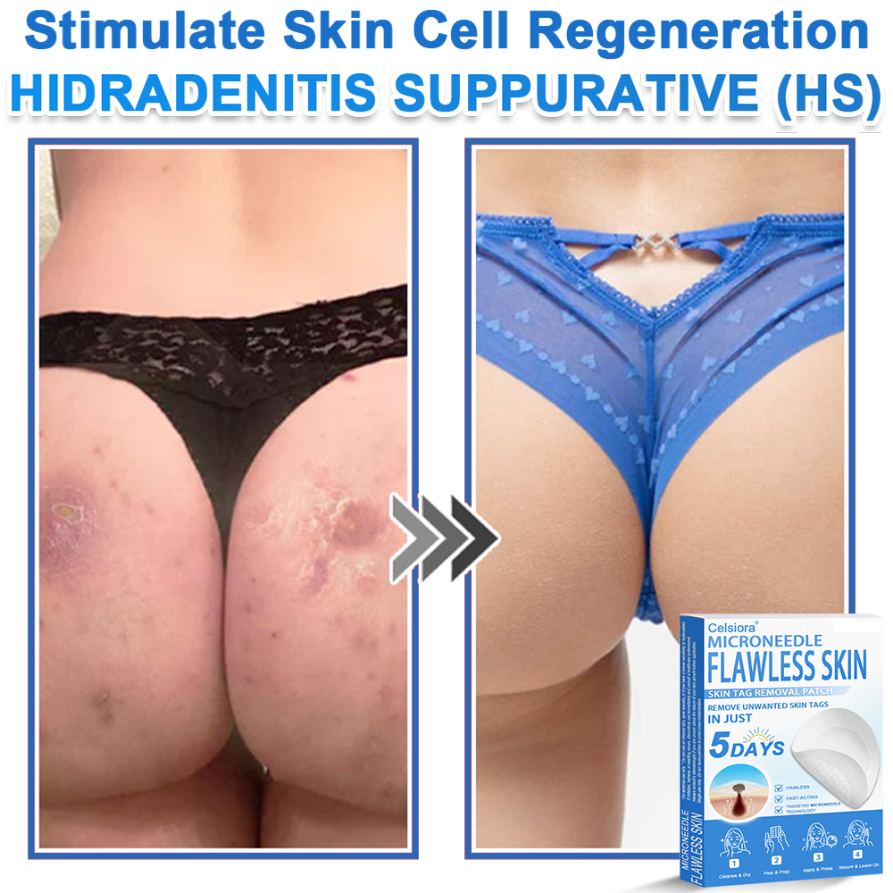 🏆 Celsiora® 2-in-1 Microneedle & Hydrocolloid Patch | Raised Moles,Acne,  Flat Warts & Skin Tags Remover | Improves Wrinkles, Scars & Blemishes | Invisible Pimple Patches for Face & Body