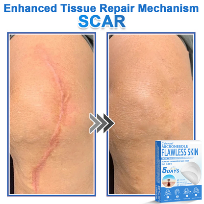🏆 Celsiora® 2-in-1 Microneedle & Hydrocolloid Patch | Raised Moles,Acne,  Flat Warts & Skin Tags Remover | Improves Wrinkles, Scars & Blemishes | Invisible Pimple Patches for Face & Body