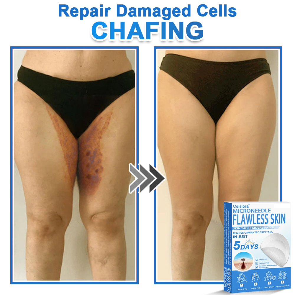 🏆 Celsiora® 2-in-1 Microneedle & Hydrocolloid Patch | Raised Moles,Acne,  Flat Warts & Skin Tags Remover | Improves Wrinkles, Scars & Blemishes | Invisible Pimple Patches for Face & Body
