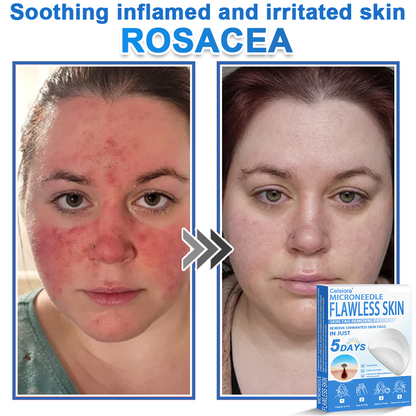🏆 Celsiora® 2-in-1 Microneedle & Hydrocolloid Patch | Raised Moles,Acne,  Flat Warts & Skin Tags Remover | Improves Wrinkles, Scars & Blemishes | Invisible Pimple Patches for Face & Body