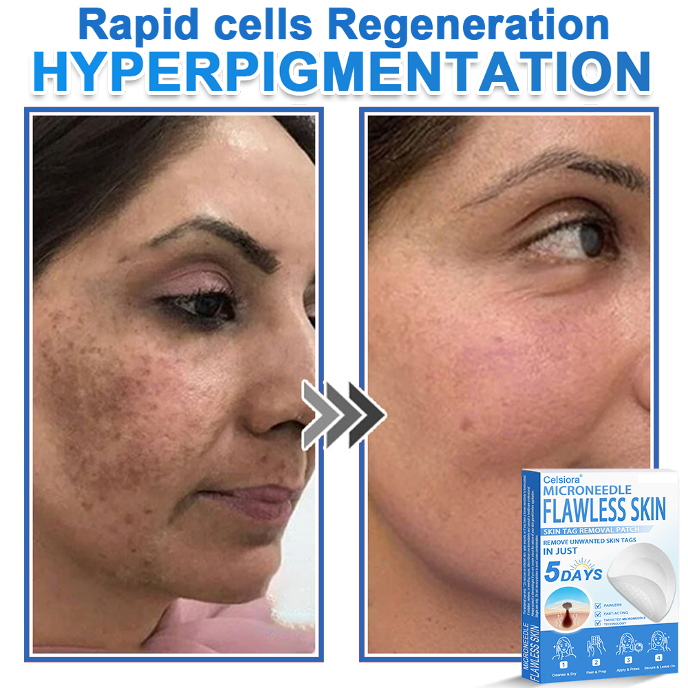 🏆 Celsiora® 2-in-1 Microneedle & Hydrocolloid Patch | Raised Moles,Acne,  Flat Warts & Skin Tags Remover | Improves Wrinkles, Scars & Blemishes | Invisible Pimple Patches for Face & Body